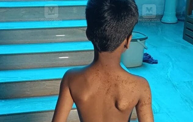 രണ്ടാം ക്ലാസുകാരനെ മർദിച്ച അധ്യാപകനെതിരെ കേസ്