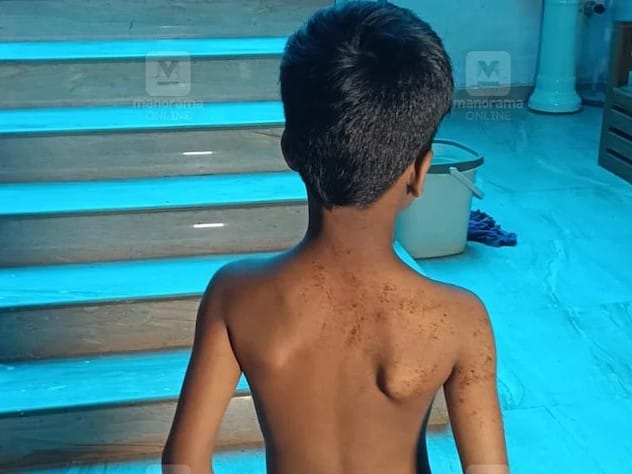 രണ്ടാം ക്ലാസുകാരനെ മർദിച്ച അധ്യാപകനെതിരെ കേസ്